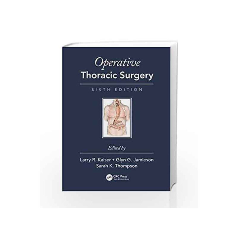 Operative Thoracic Surgery by Kaiser L.R. Book-9781482299571