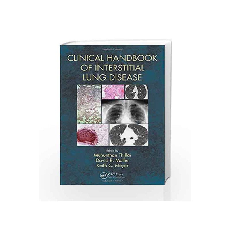 Clinical Handbook of Interstitial Lung Disease by Thillai M Book-9781138296701