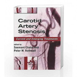 Carotid Artery Stenosis: Current and Emerging Treatments (Neurological Disease and Therapy) by Bayindirli Book-9780824754174