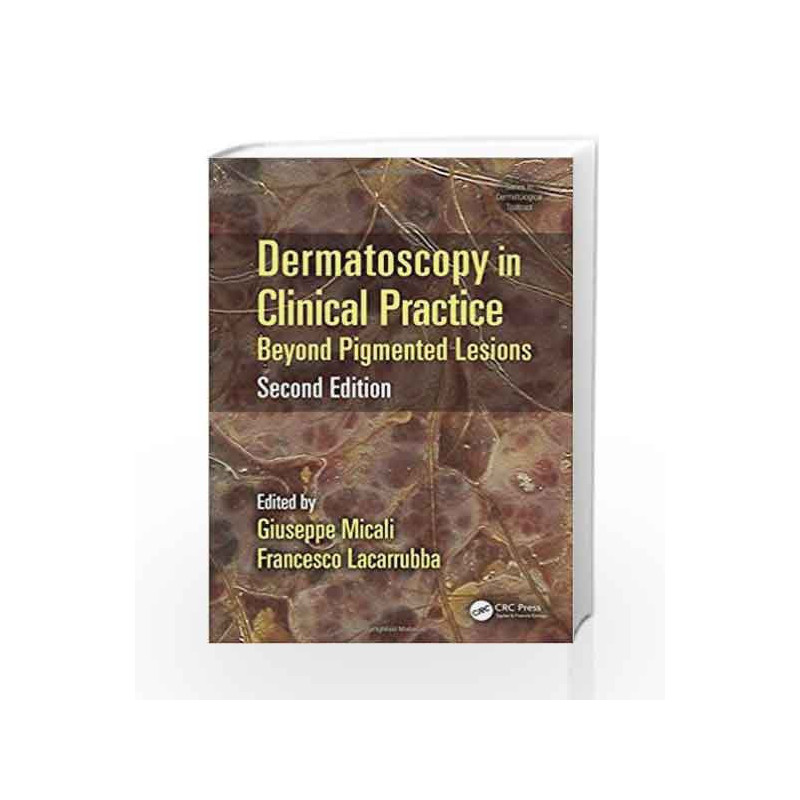 Dermatoscopy in Clinical Practice: Beyond Pigmented Lesions (Series in Dermatological Treatment) by Micali G Book-9781482225952