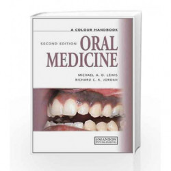 Oral Medicine, Second Edition (Medical Color Handbook Series) by Lewis Book-9781840761818