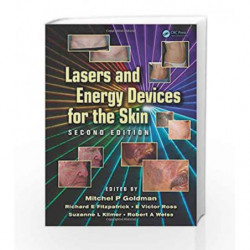 Lasers and Energy Devices for the Skin by Goldman M.P. Book-9781841849331