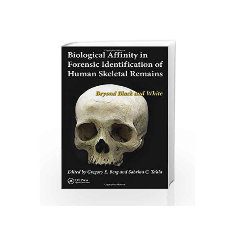 Biological Affinity in Forensic Identification of Human Skeletal Remains: Beyond Black and White by Berg G E Book-9781439815755