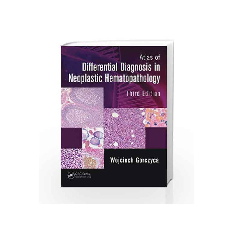 Atlas of Differential Diagnosis in Neoplastic Hematopathology by Gorczyca W. Book-9781482212211