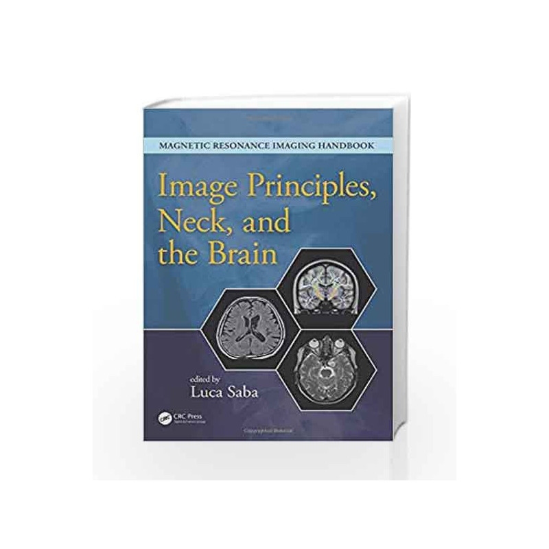 Image Principles, Neck, and the Brain: Volume 1 (Magnetic Resonance Imaging Handbook) by Saba Book-9781482216134