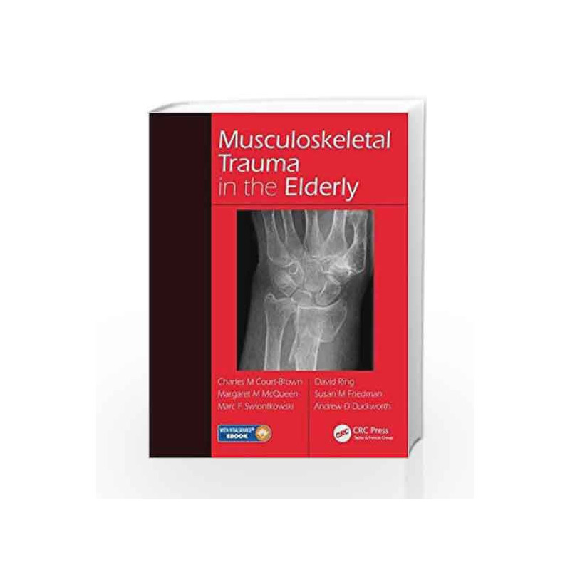 Musculoskeletal Trauma in the Elderly by Court-Brown C M Book-9781482252026