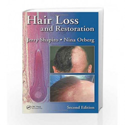 Hair Loss and Restoration by Shapiro Book-9781482231977
