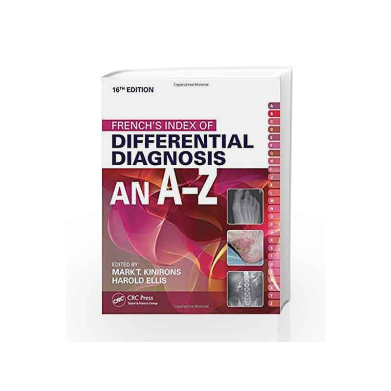 French's Index of Differential Diagnosis An A-Z 1 by Kinirons M T Book-9781482230703