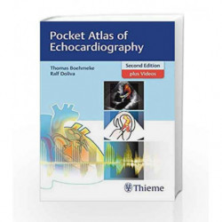 Pocket Atlas of Echocardiography by Boehmeke T. Book-9783132417229