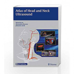 Atlas of Head and Neck Ultrasound by Iro H. Book-9783131603517