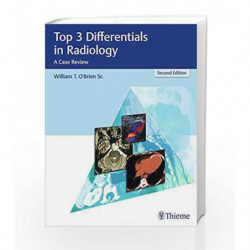 Top 3 Differentials in Radiology: A Case Review by O\'Brien W.T. Book-9781626232785