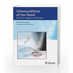 Osteosynthesis of the Hand: Instruments, Implants, and Techniques by Foerstner H. Book-9783132038110