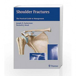 Shoulder Fractures: The Practical Guide to Management by Zuckerman Book-9781588903105