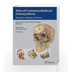 Atlas of Craniomaxillofacial Osteosynthesis: Microplates, Miniplates and Screws by Haerle Book-9783131164926