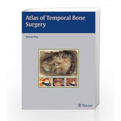 Atlas of Temporal Bone Surgery by Ulug Book-9783131471512