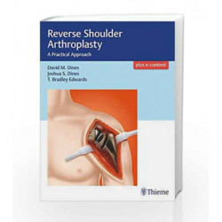 Reverse Shoulder Arthroplasty: A Practical Approach by Dines D.M. Book-9781626233607