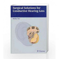 Surgical Solutions for Conductive Hearing Loss: Man Middle Ear Surgery - Vol. 4 by Tos M. Book-9783131216410