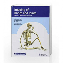 Imaging of Bones and Joints: A Concise, Multimodality Approach by Bohndorf K. Book-9783132406476