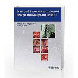 Transoral Laser Microsurgery of Benign and Malignant Lesions by Bernal-Sprekelsen M. Book-9783131723918