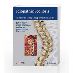 Idiopathic Scoliosis: The Harms Study Group Treatment Guide by Newton P.O. Book-9781604060249