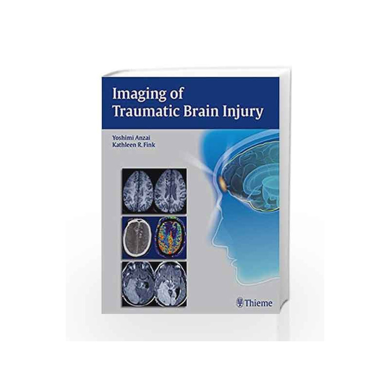 Imaging of Traumatic Brain Injury by Anzai Y. Book-9781604067286