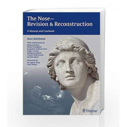 The Nose - Revision and Reconstruction: A Manual and Casebook by Behrbohm H. Book-9783131435910