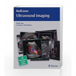 Ultrasound Imaging (Radcases) by Azar N. Book-9781604063226