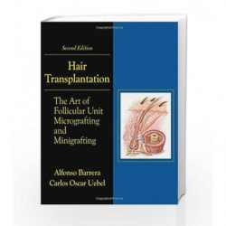 Hair Transplantation: The Art of Micrografting and Minigrafting, Second Edition by Barrera Book-9781576263723