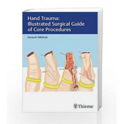 Hand Trauma: Illustrated Surgical Guide of Core Procedures by Nikkhah D. Book-9783132414266
