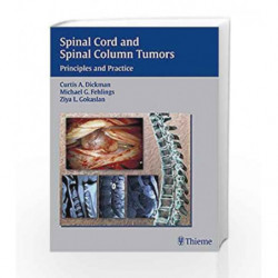 Spinal Cord and Spinal Column Tumors: Principles and Practice by Dickman C.A. Book-9783131307712