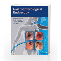 Gastroenterological Endoscopy by Classen Book-9789380378312