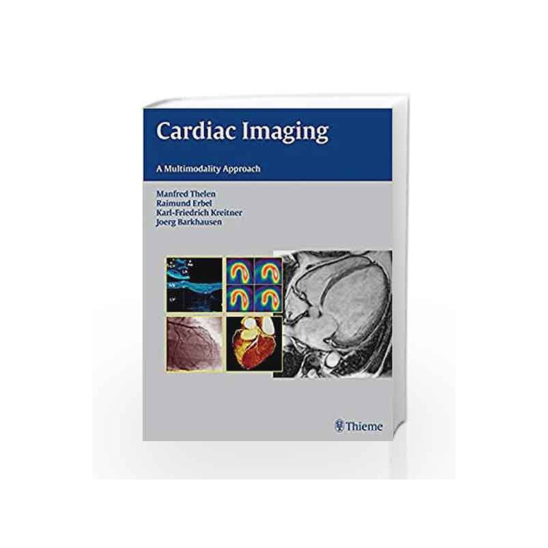 Cardiac Imaging: A Multimodality Approach by Thelen Book-9783131477811