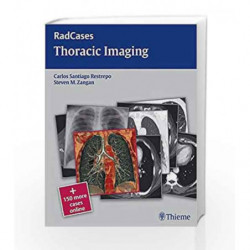 Thoracic Imaging: RadCases by Restrepo C.S. Book-9781604061871