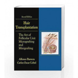 Hair Transplantation: The Art of Micrografting and Minigrafting by Barrera A Book-9781626236219