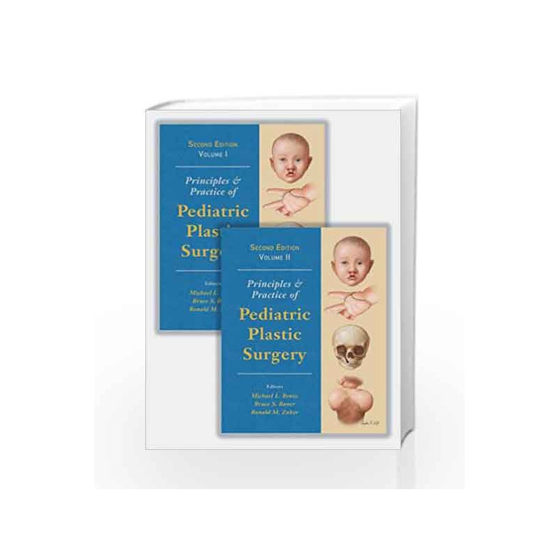 Principles and Practice of Pediatric Plastic Surgery, Second Edition - Two Volume Set by Bentz M L Book-9781482241372
