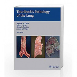 Thurlbeck's Pathology of the Lung by Churg A.M. Book-9781588902887