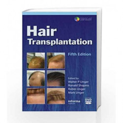 Hair Transplantation, Fifth Edition (Series in Cosmetic and Laser Therapy) by Unger W.P. Book-9781616310066