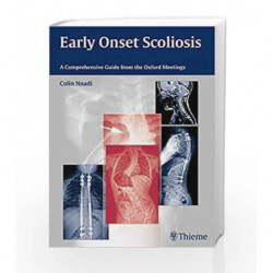 Early Onset Scoliosis: A Comprehensive Guide from the Oxford Meetings by Nnadi C. Book-9783131726612