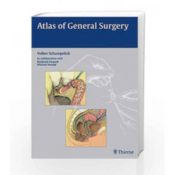 Atlas of General Surgery by Schumpelick V. Book-9783131440914